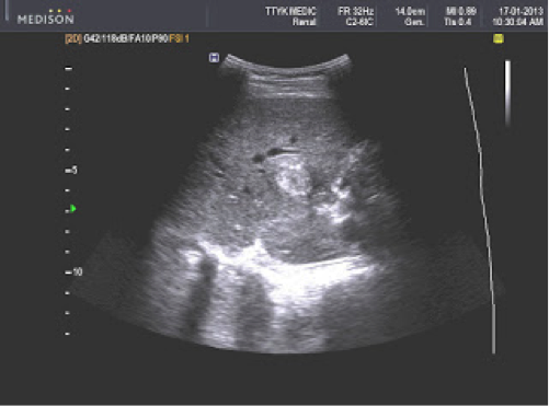 Description: http://2.bp.blogspot.com/-Q7UMH0ARfOk/UU6OG_F2tSI/AAAAAAAALGw/dwEdeVuobuI/s320/172_BG5_0001.jpg