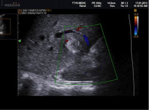 Description: http://3.bp.blogspot.com/-PucxB0UkFCE/UU6OKWmvlVI/AAAAAAAALG4/2jLiFcx30xQ/s320/172_BG5_0002.jpg