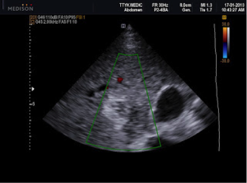 Description: http://1.bp.blogspot.com/-tEAnG1aS_MM/UU6OOXiPd1I/AAAAAAAALHA/NVdnhmZChyE/s320/172_BG5_0004+(1).jpg