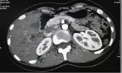 Description: http://3.bp.blogspot.com/-ovR1kzPvkV8/UU-_ax0PesI/AAAAAAAALHY/16JH0WZvtMo/s320/172_082236.png