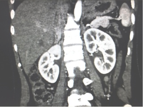 Description: http://4.bp.blogspot.com/-O4oCFGW8FQI/UU-_cHCrZhI/AAAAAAAALHk/LbLrWIqvc4o/s320/172_082251.png