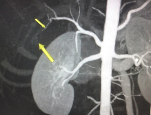 Description: http://1.bp.blogspot.com/-gif5vMyPEpY/UU-_bHR1HbI/AAAAAAAALHU/CBib2LLrbL0/s320/172_082218.png