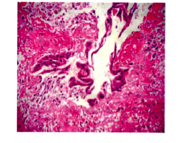 Description: G:\CHỬA TRONG Ổ BUNG\4.JPG