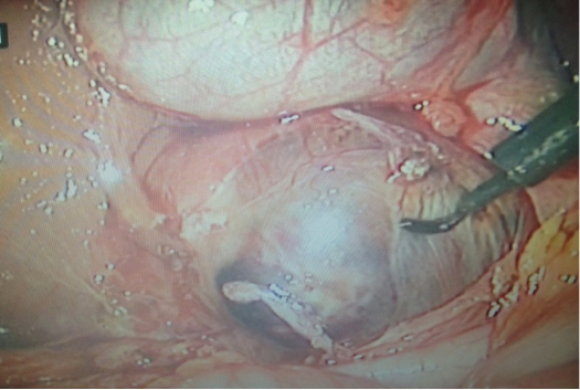 Description: C:\Users\VUONGT~1\AppData\Local\Temp\photo.JPG