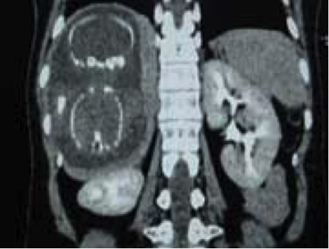 Description: http://www.tin247.com/cand/080906071150-160-328.jpg