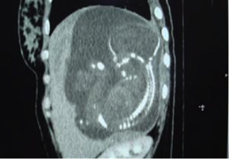 Description: ImageView