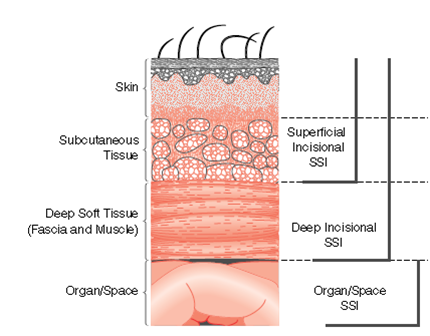 Description: ssi.png