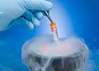 12-9-cryopreservation