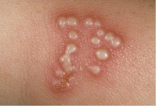 Picture_78