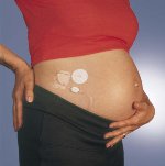 diabetes_mellitus