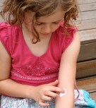 eczema