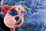 hiv-budding-color_1