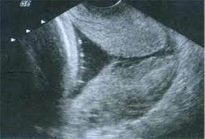 n4_2