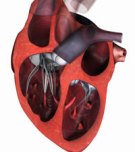 natriuretic-peptide-2