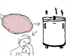 ovarian_tissue_freeze