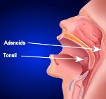 tonsil