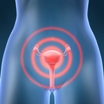 vaginitis