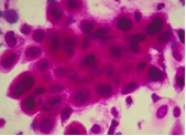 xetnghiem1