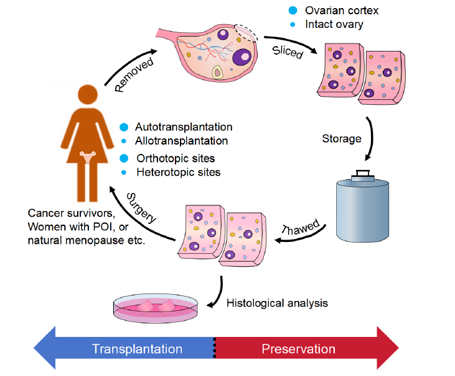 Cập nhật kết quả đông lạnh mô buồng trứng –  Bảo tồn khả năng sinh sảnCập nhật kết quả đông lạnh mô buồng trứng –  Bảo tồn khả năng sinh sản