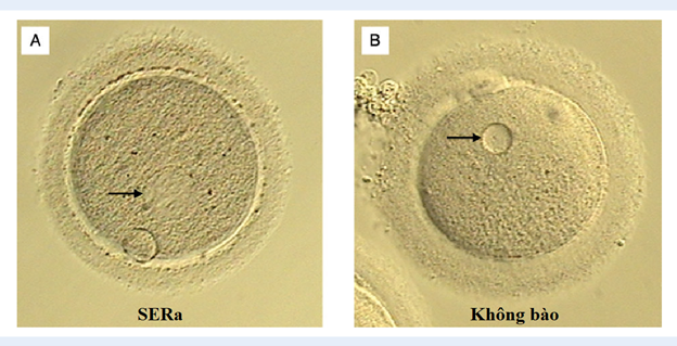 Sự hình thành và cơ chế sinh học của cụm lưới nội chất trơn trong noãn