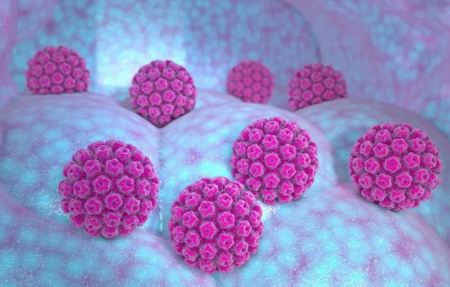 Bệnh sùi mào gà (hpv) ở phụ nữ mang thai chẩn đoán, theo dõi và xử trí